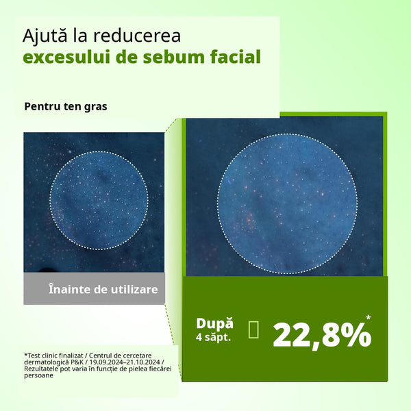 Ser antirid calmant pentru ten